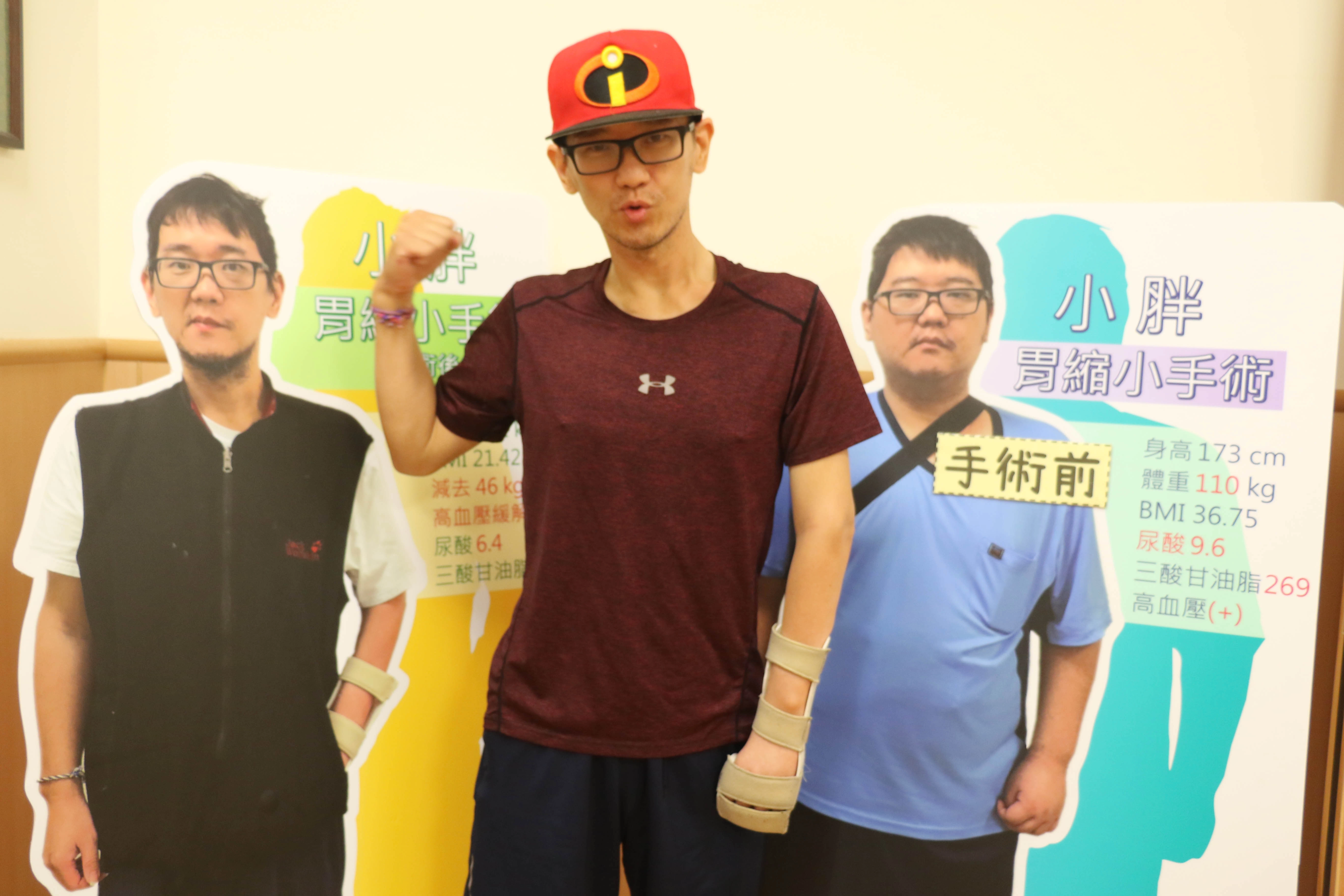 跟減重手術前相較，林先生瘦了四十多公斤並持續運動。