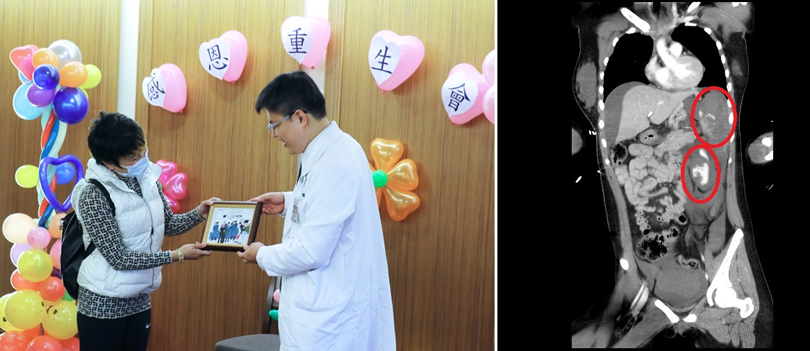 外科部主任余政展(右 )將葳葳的手術搶救圖送給媽媽，成為最特別的禮物。葳葳手術前的電腦斷層檢查，顯示脾臟（上）腎臟（下）嚴重受損。
