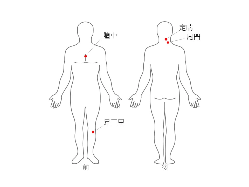 足三里、風門、膻中及定喘四個核心穴位位置示意圖穴位(Hsieh, ECAM 2020)。