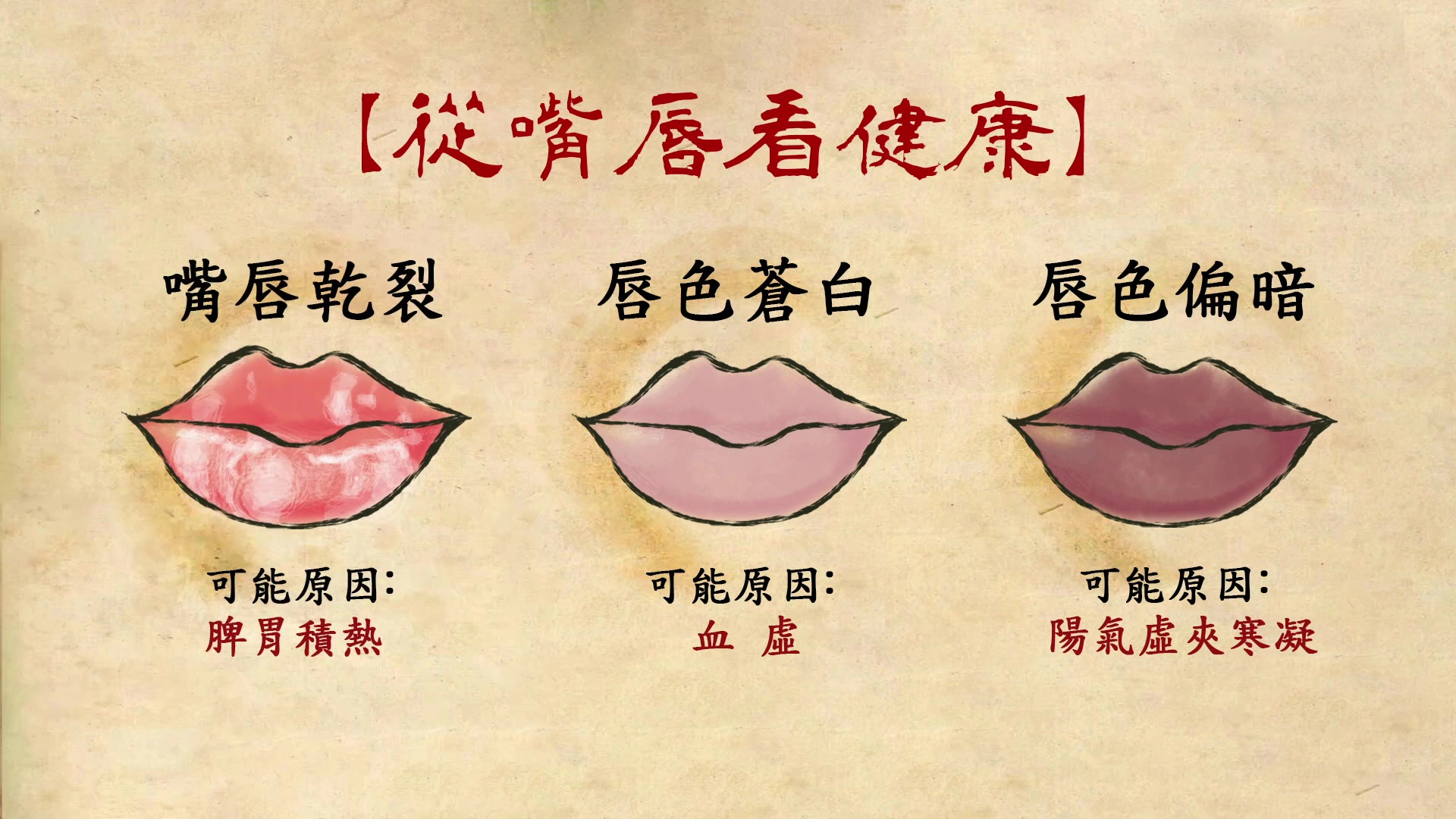 嘴唇脫皮還有發炎現象，就表示脾胃積熱。