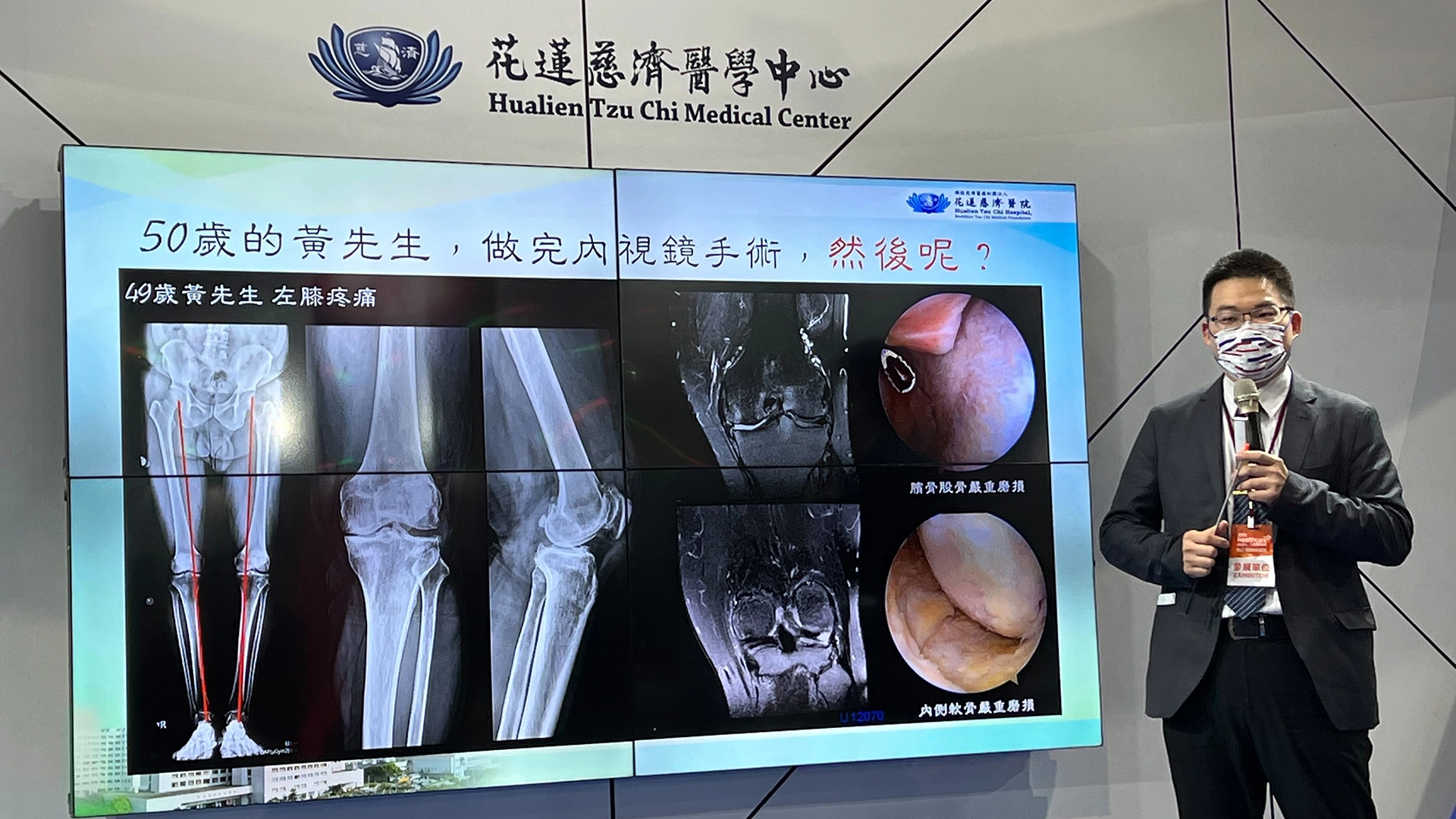 劉冠麟主任分享關節炎治療新趨勢。