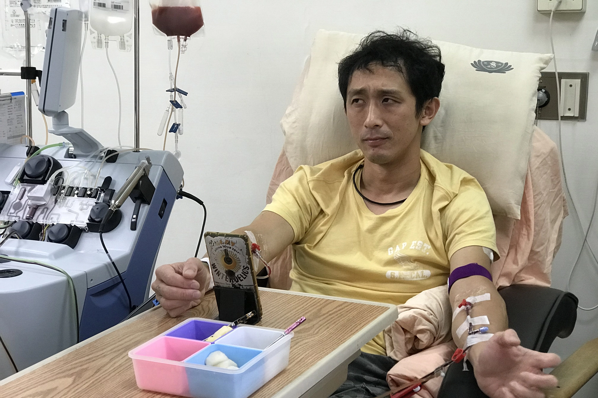 蔡豐燦以「採集周邊血收集造血幹細胞」為捐贈方式，當這次再度扎針時，他很清楚知道再次走進醫院不是為了自己，而是要救另一個人。