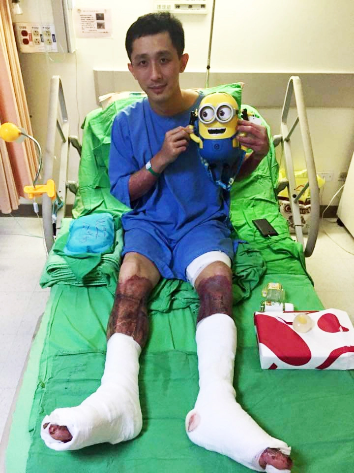 曾是八仙塵爆傷者之一，蔡豐燦四肢特別是雙腿有大面積嚴重燒燙傷，在歷經長達兩個多月的植皮治療過程，「打針」對他曾是一大夢魘。