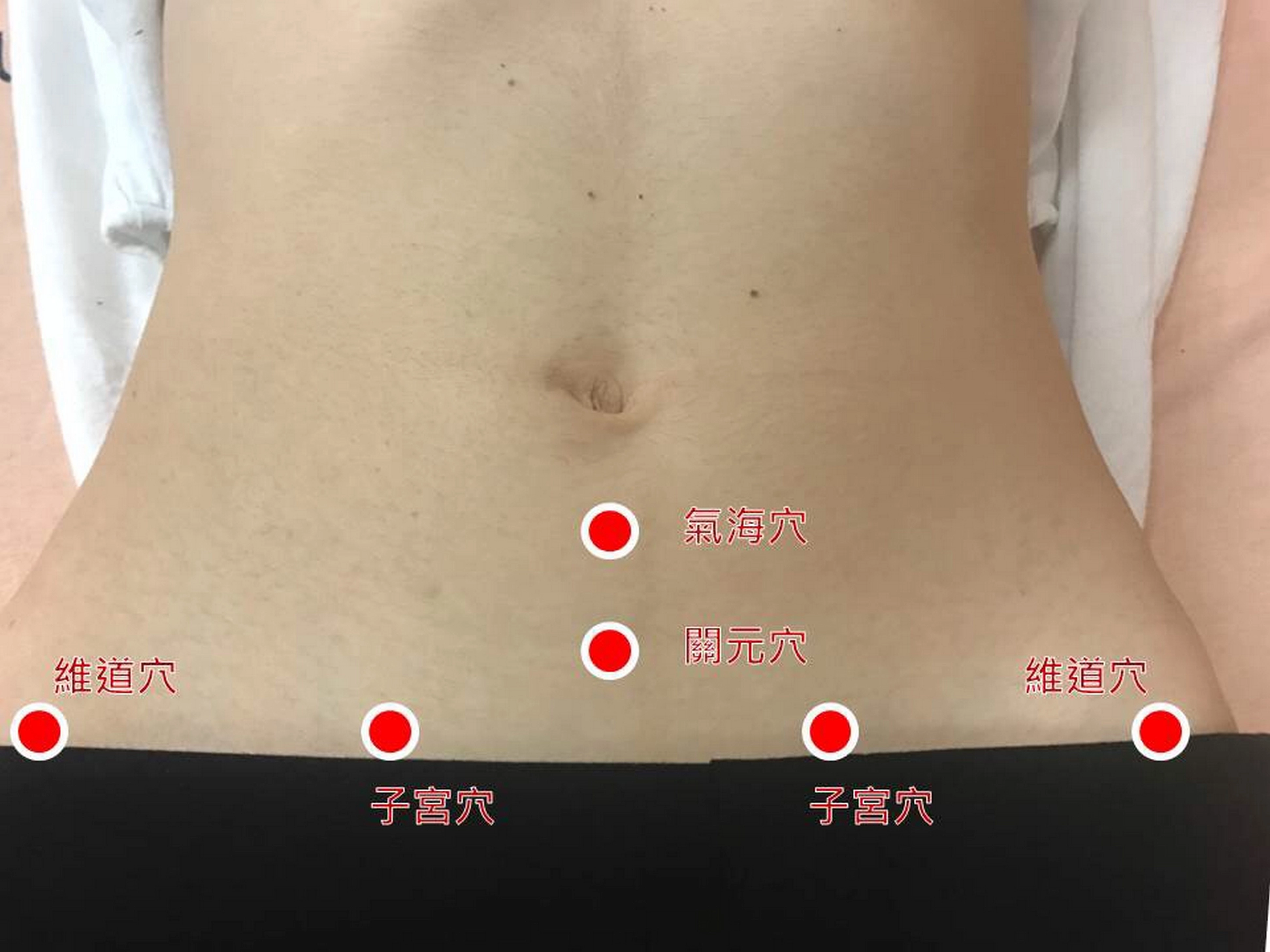 緩解痛經、虛寒型腹脹腹瀉敷貼穴位示意圖。