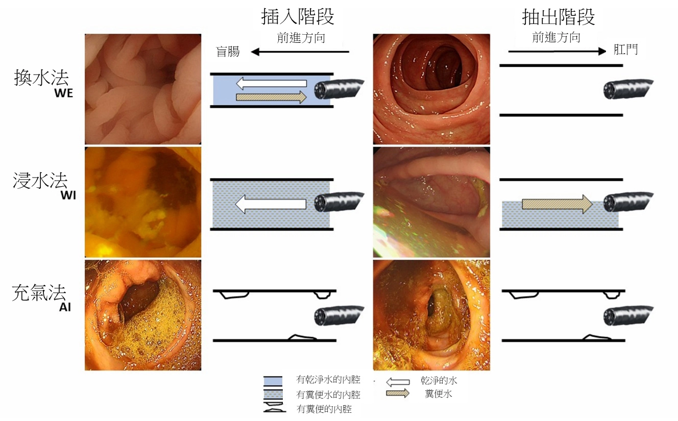 大腸鏡檢查法比較