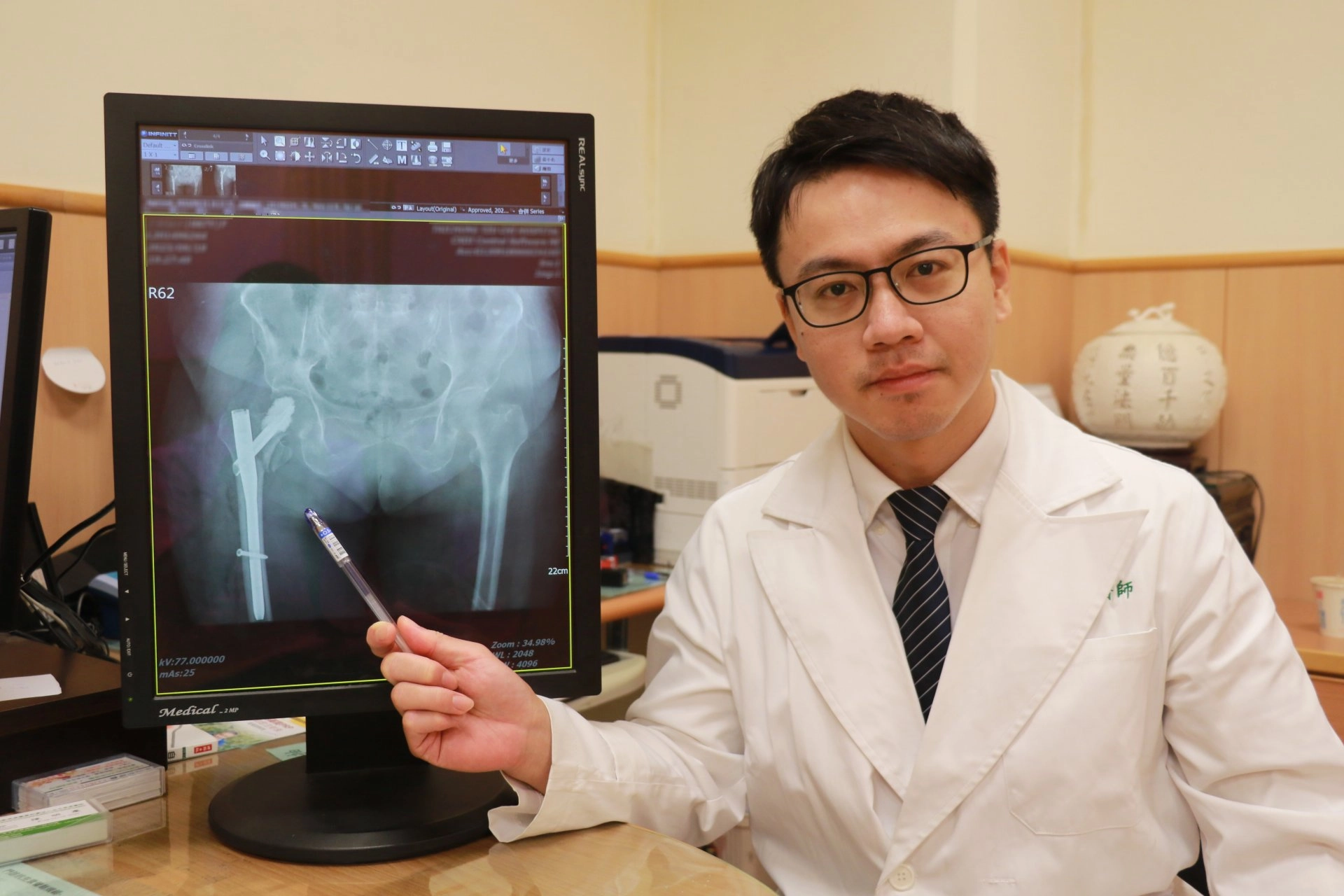 陳明慶醫師指出微創骨髓內釘固定讓病人提早復健與行走。