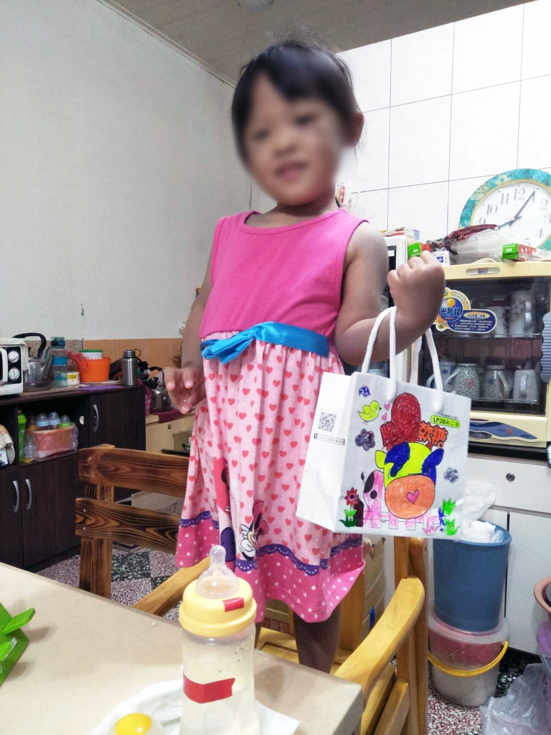 小真出生從小腿以上都是紫青色胎記