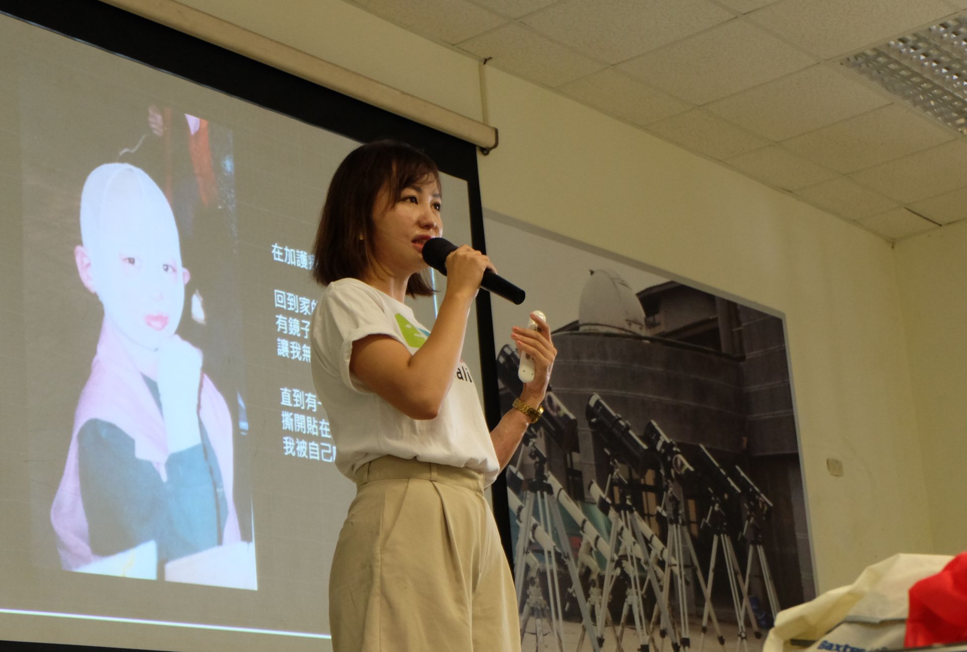 燒傷致顏損的采瑀曾遇不友善面試經驗 積極投入宣導臉部平權