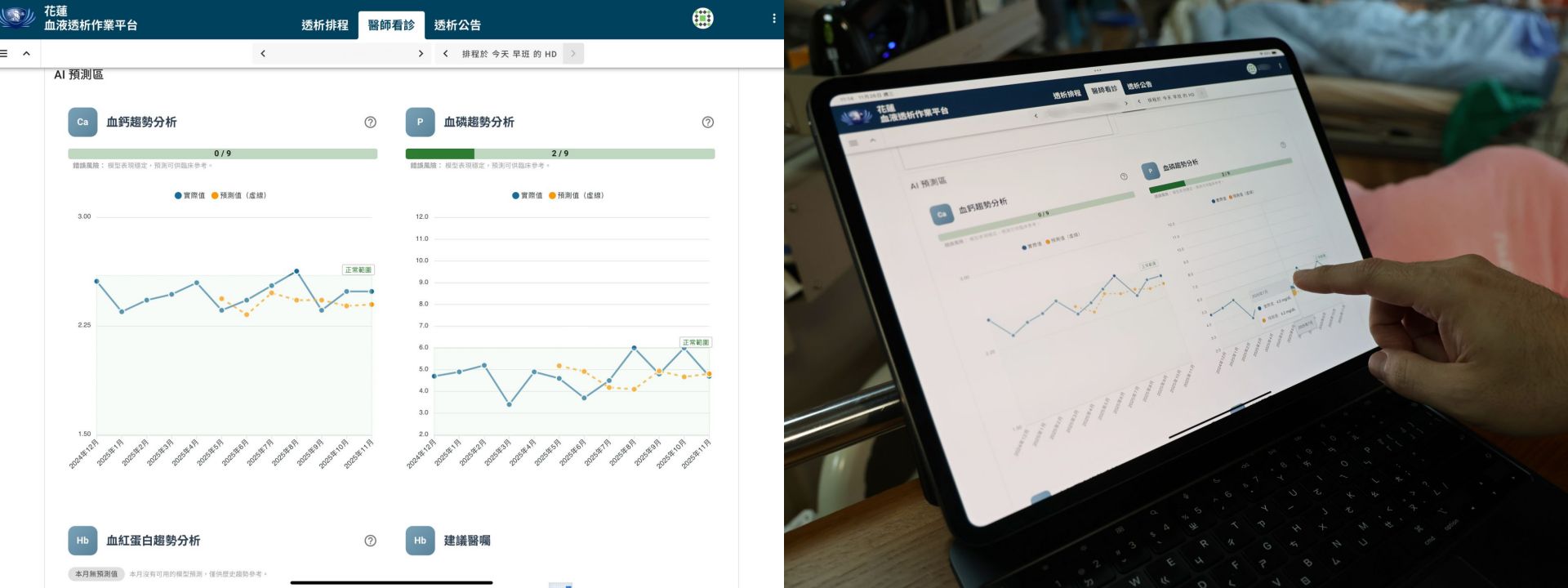 花蓮慈濟醫院今年也在血液透析作業平台中導入 AI 預測功能，協助醫護更早掌握病人狀況。