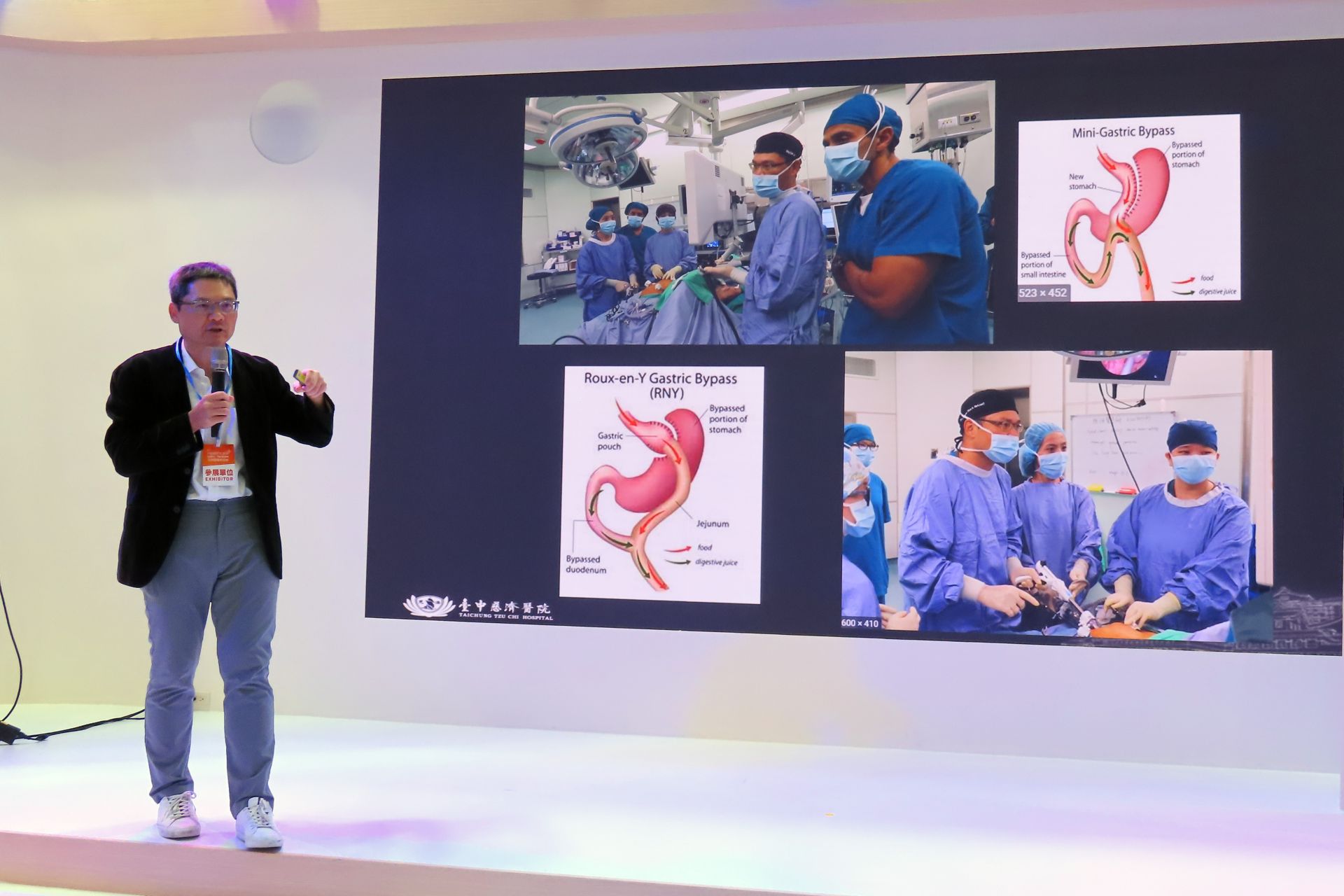李旻憲透過簡報介紹胃繞道手術。