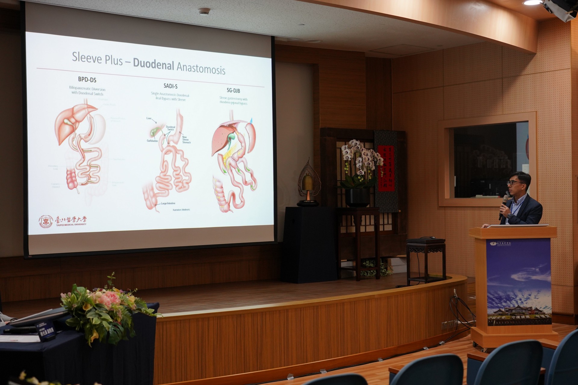 臺北醫學大學雙和醫院代謝及體重管理中心主任深入剖析SASI（雙通道胃繞道手術）與LSG（縮胃手術）之比較。