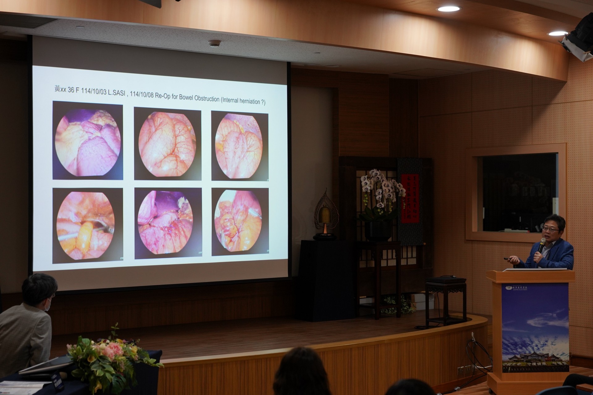中壢天晟醫院副院長徐光漢以實際案例，分享減重手術併發症的判斷與處置經驗。