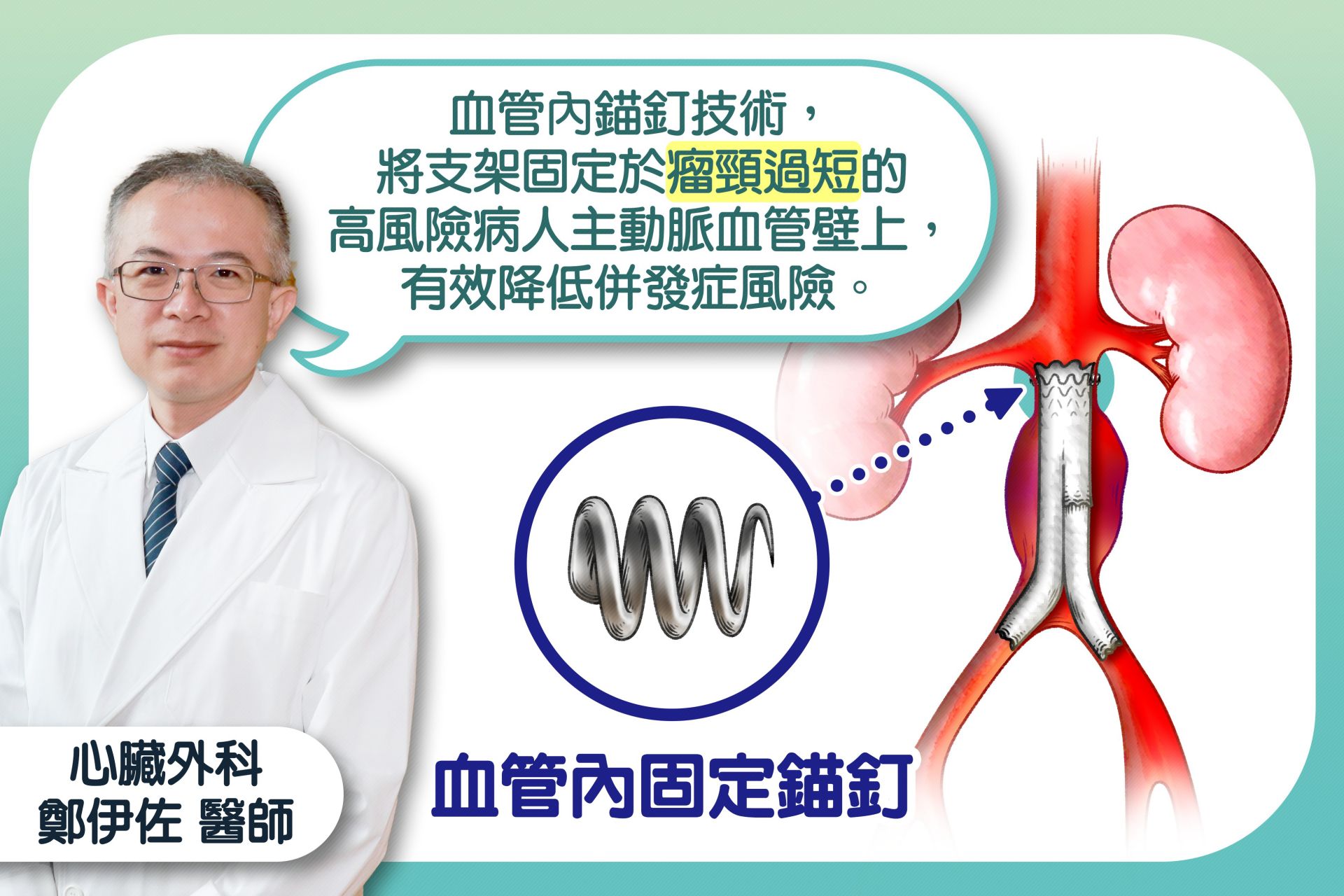 血管內錨釘技術，將支架固定於瘤頸過短的高風險病人主動脈血管壁上，有效降低併發症風險。
