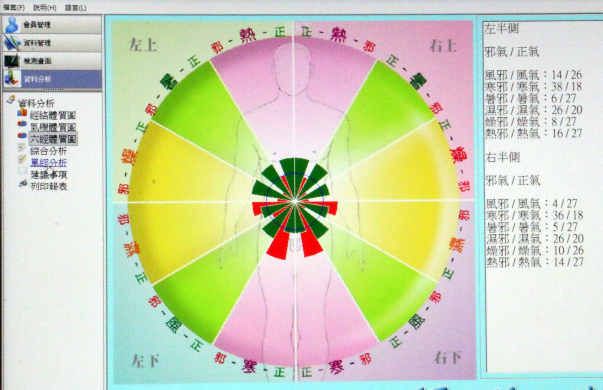 經絡能量檢測儀量測結束後，會產生一張能量圖，讓民眾參考。