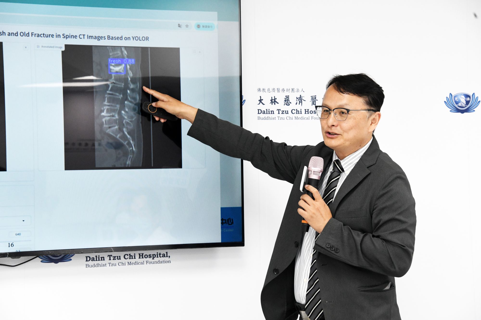 雲科大校長張傳育表示，骨科團隊與雲科大合作的AI系統，不僅補足CT影像診斷的限制，更能在第一線提供醫師精準判斷依據，協助患者早期治療、避免後續併發症，成果有意義，令人感到振奮。