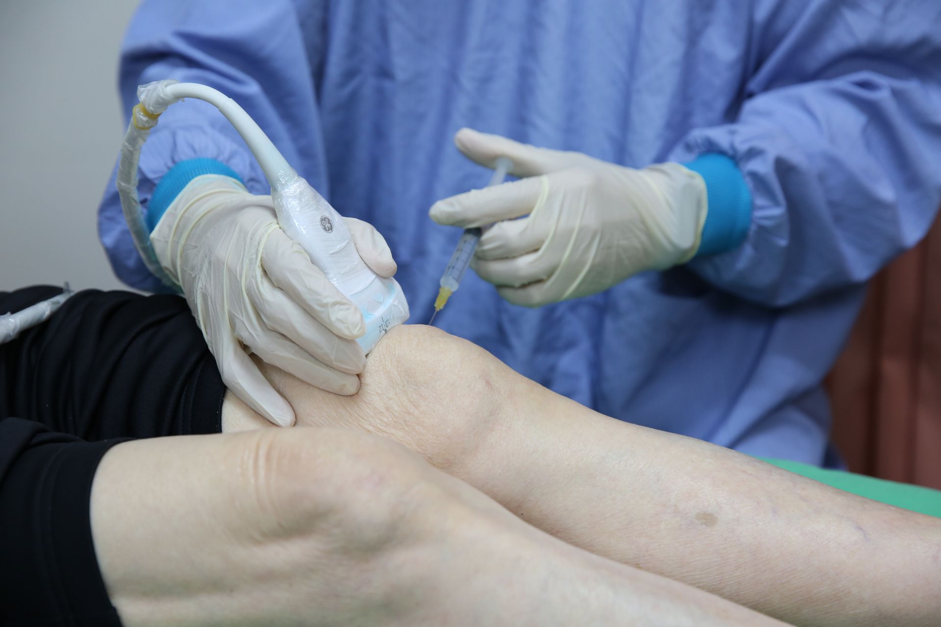 細胞研製中心將病人自體骨髓幹細胞培養出高品質且數量充足的細胞製劑後，由醫師精準注射回病人膝關節腔內，即可啟動修復。