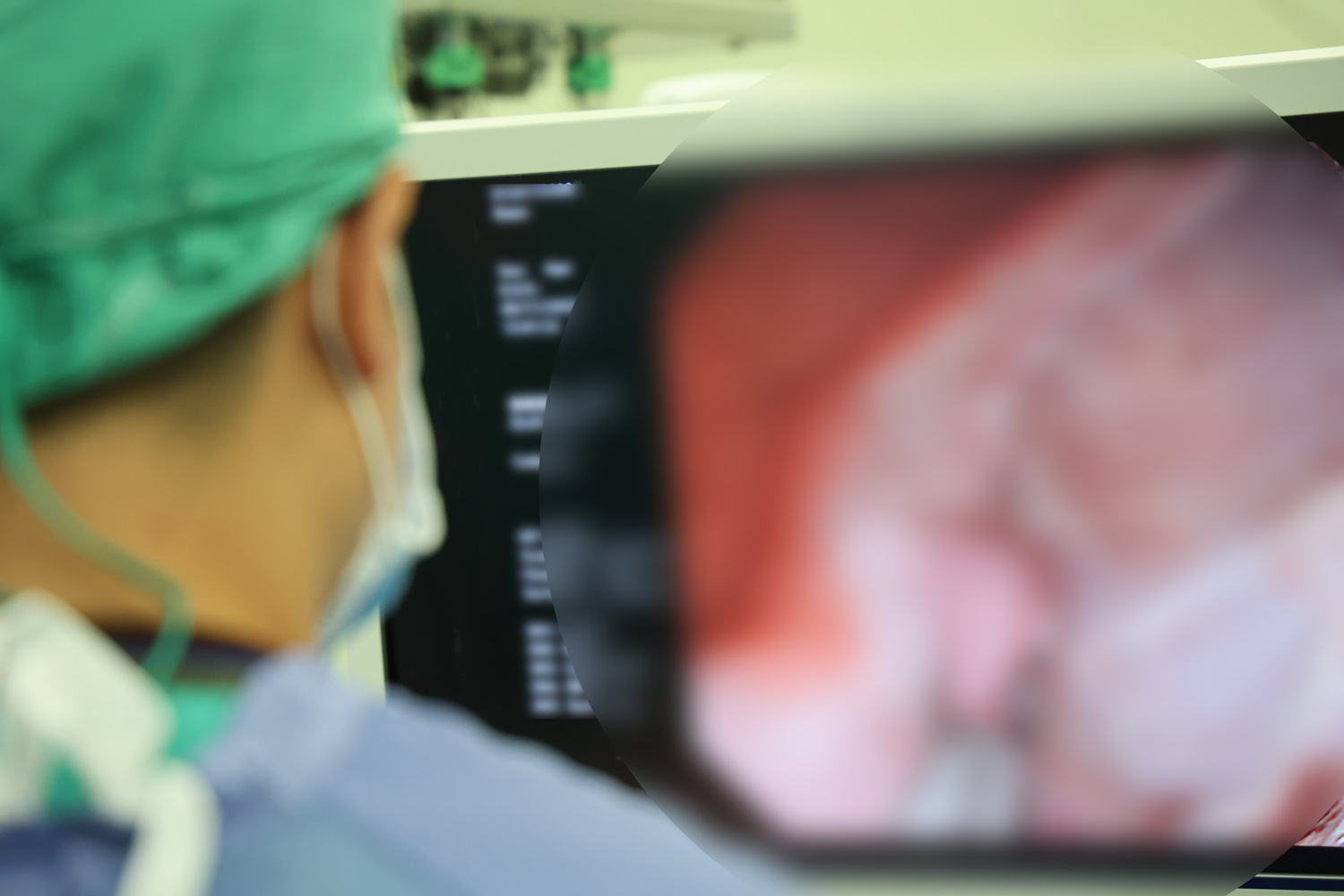 以內視鏡切除腫瘤後，醫師再以止血夾將小傷口關閉，微創手術即大功告成。