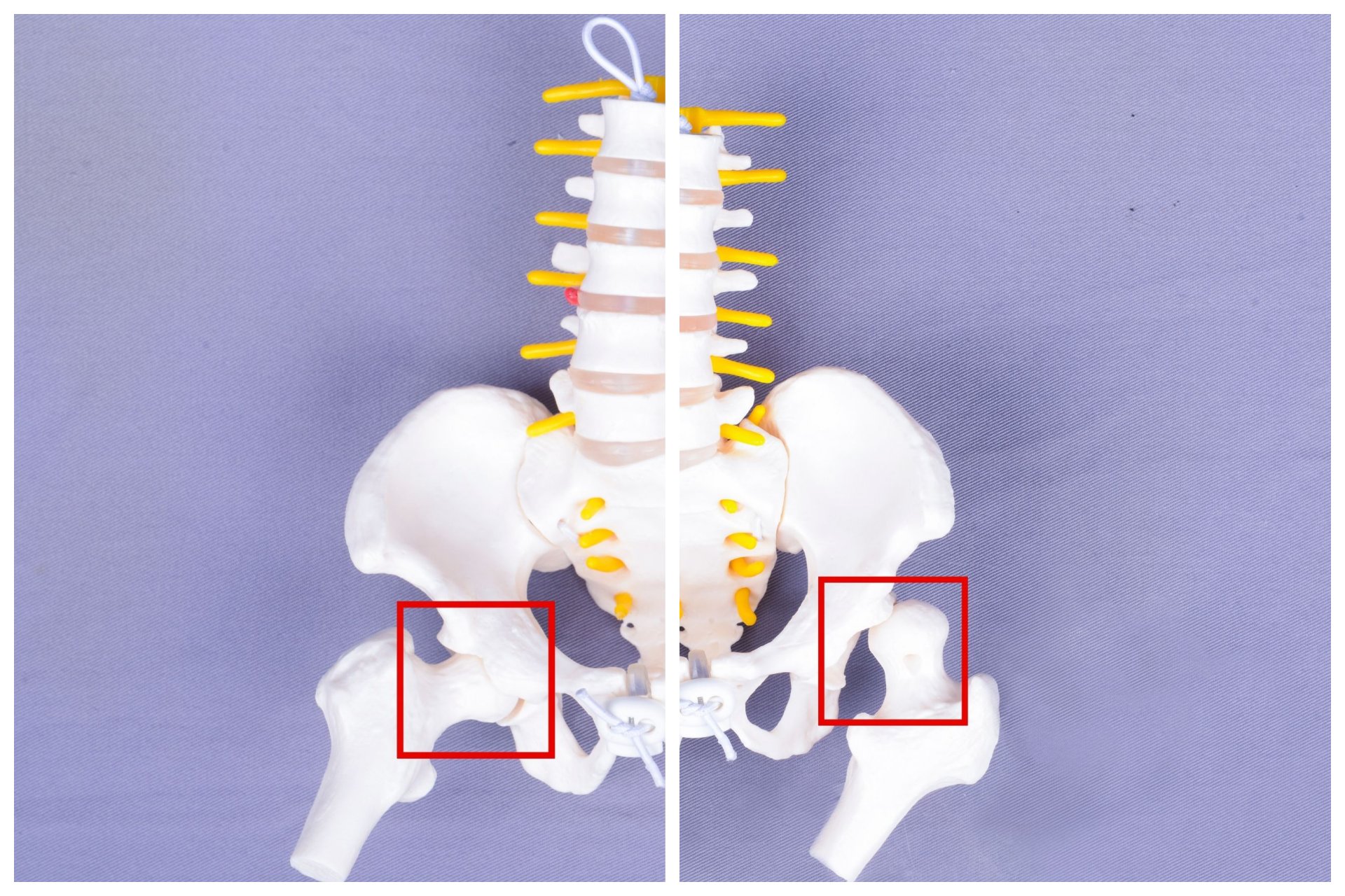 協助維持自然「M字腿」姿勢，有助於股骨頭穩定嵌合於髖臼中(左)；若家長在揹抱時經常將嬰兒雙腳打直，恐導致發育異常或脫臼(右)。