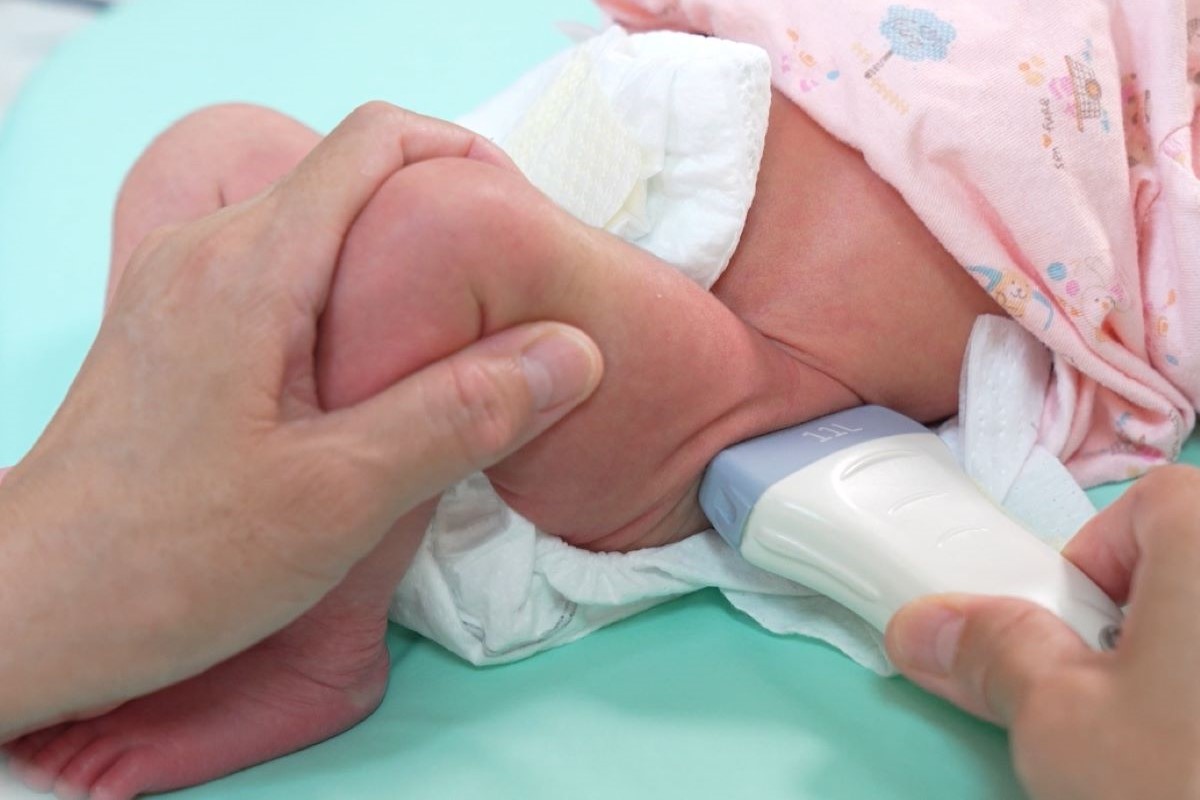 守護寶寶健康學步 台北慈院推動小兒髖關節超音波篩檢