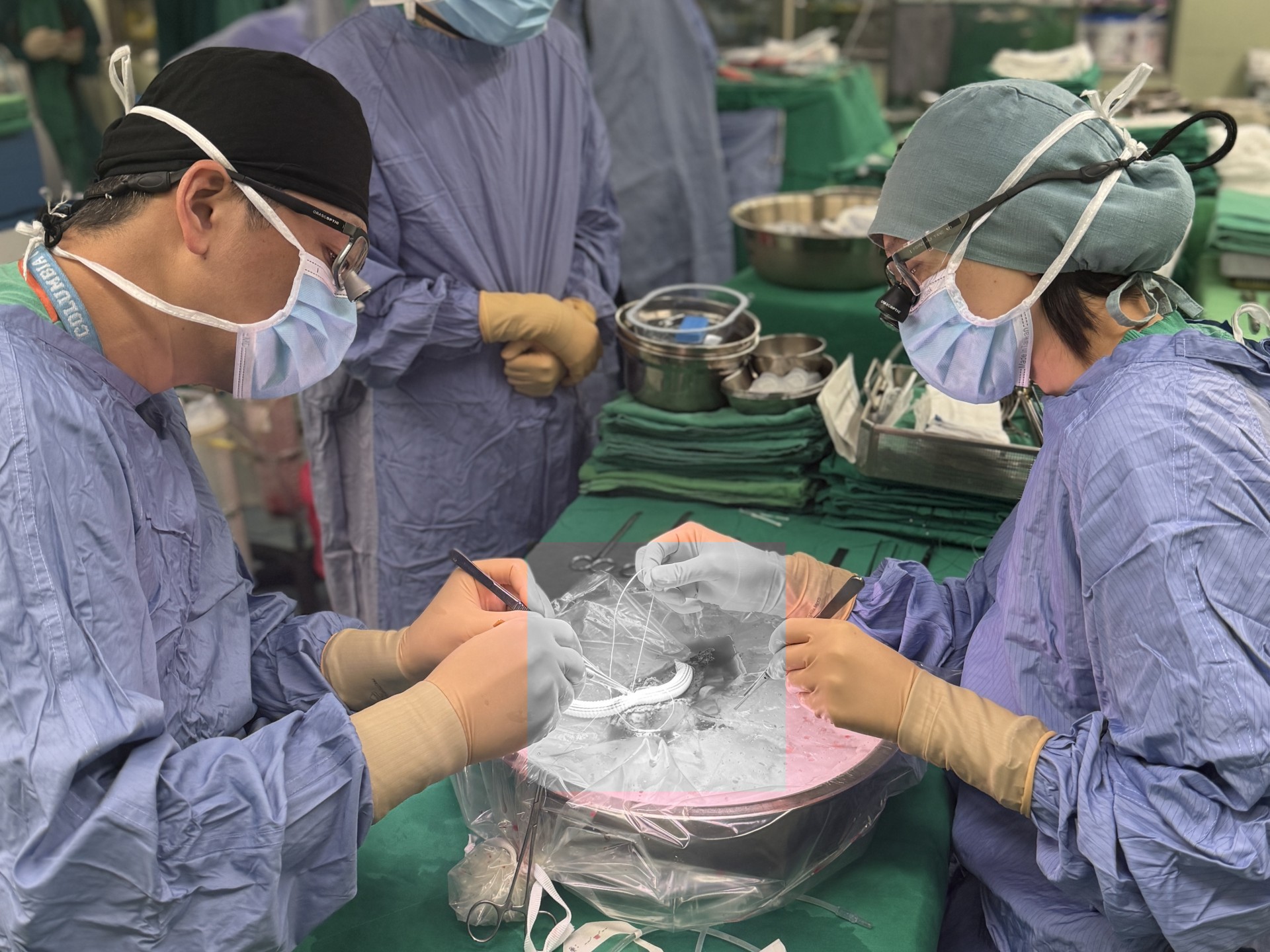 外科部主任陳言丞與小兒外科楊筱惠醫師細心地處理從捐贈的女兒身上取出的部分肝臟，這也是完成肝臟移植的重要關鍵。