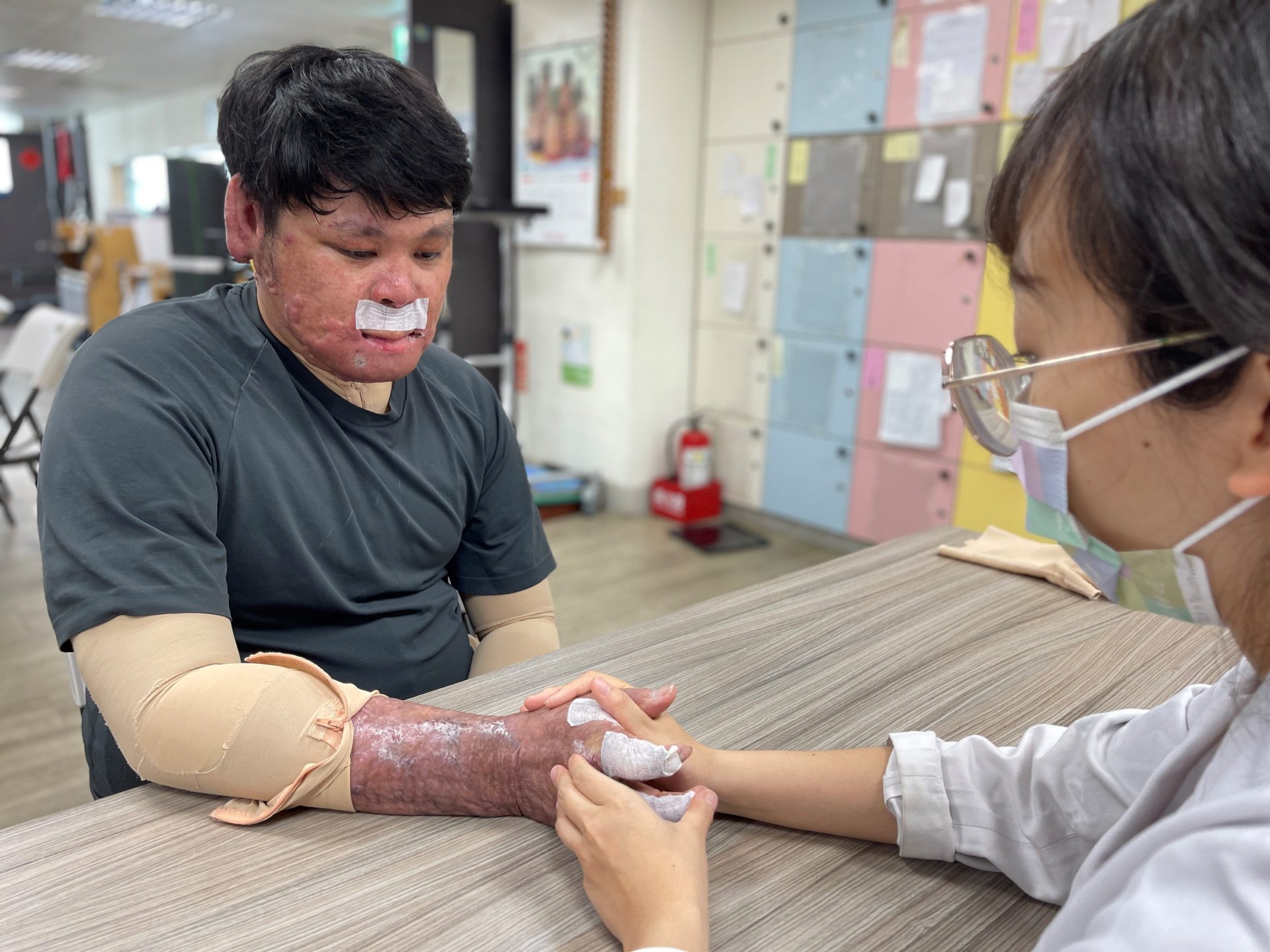 氣爆嚴重燒傷 陽光邀請持燒傷生心理重建服務