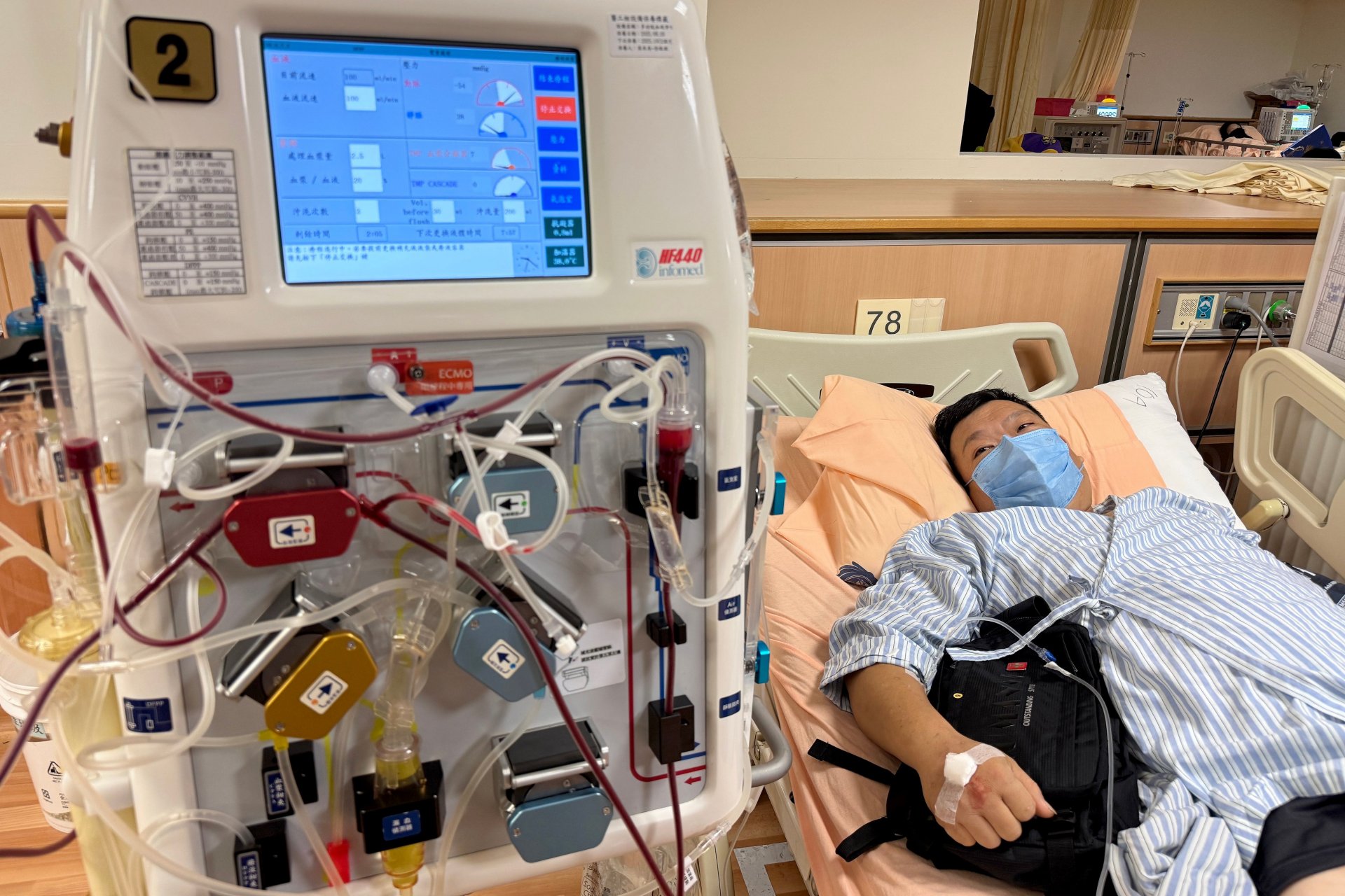 張先生因重症肌無力且體內抗體濃度過高，經腎臟內科醫師楊洵評估，以血漿置換術移除致病抗體，順利穩定病情。