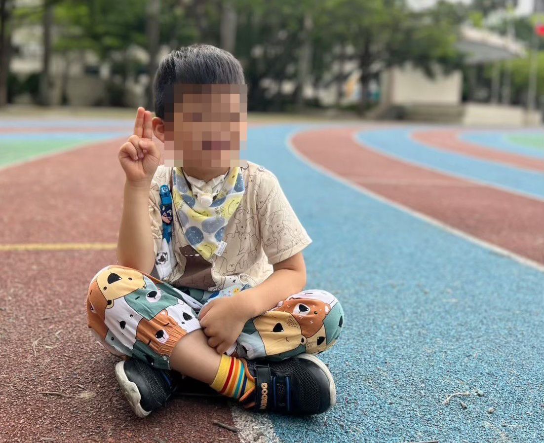 曾因外觀遭圍觀 現在的宸寶不再畏懼眼光 開心享受校園生活