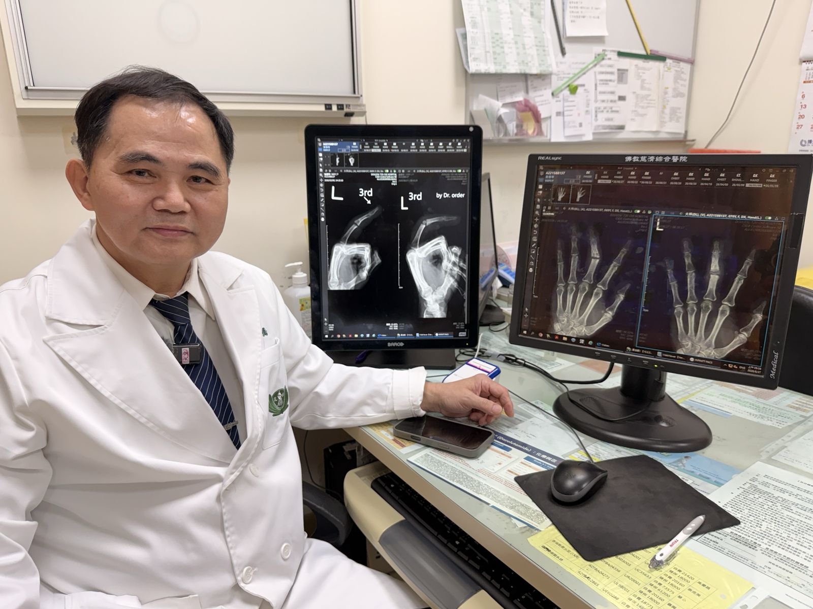斗六慈濟醫院簡瑞騰院長近期引進「指間人工關節」,並完成第一例手術